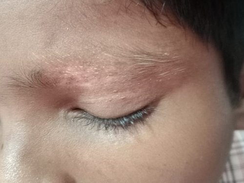 After
